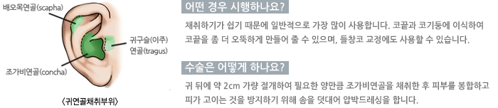 �Ϳ���ä�����/� ��� �����ϳ���?/������ ��� �ϳ���?