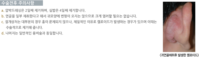 �������� ���ǻ���