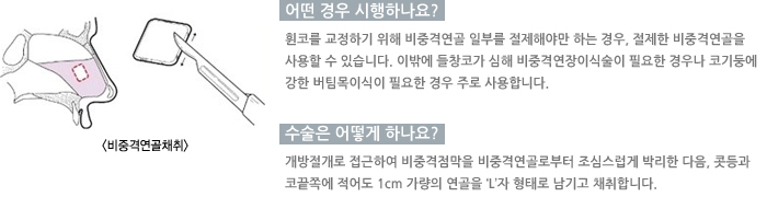 �Ϳ���ä�����/� ��� �����ϳ���?/������ ��� �ϳ���?