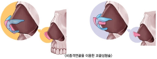 ���߰ݿ���ä��