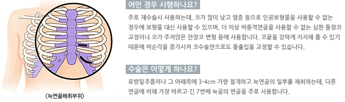 �Ϳ���ä�����/� ��� �����ϳ���?/������ ��� �ϳ���?