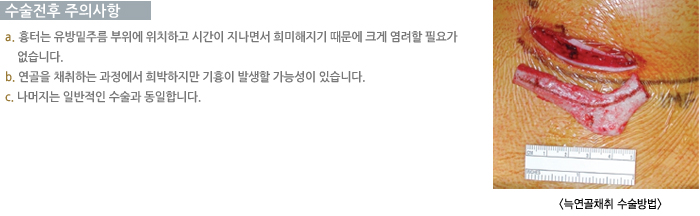 �������� ���ǻ���