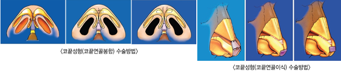 �ڳ�����(�ڳ��������) �������/ �ڳ�����(�ڳ������̽�) �������