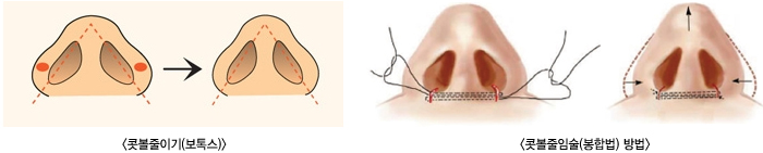 �ຼ���̱�(���彺)/�ຼ���Ӽ�(���չ�)���