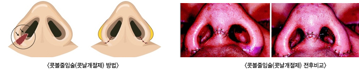 �ຼ���Ӽ�(�೯������)���/�ຼ���Ӽ�(�೯������)���ĺ�