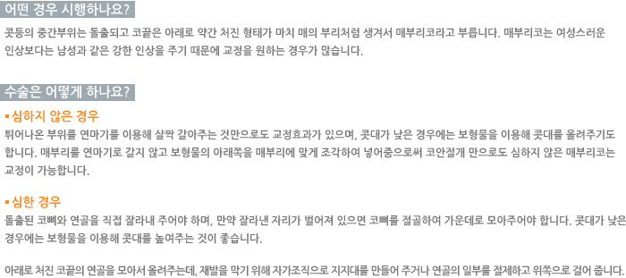 � ��� �����ϳ���?/������ ��� �ϳ���?