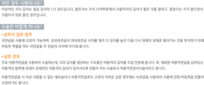 � ��� �����ϳ���?/������ ��� �ϳ���?