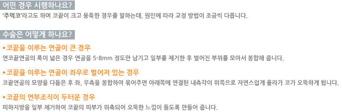 � ��� �����ϳ���?/������ ��� �ϳ���?