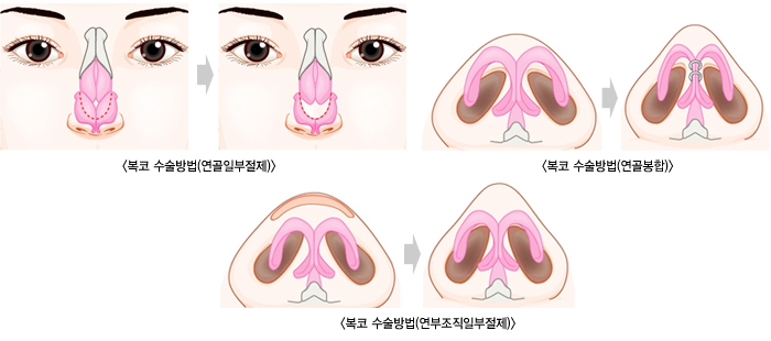 ���� �������1/���� �������2/���� �������3