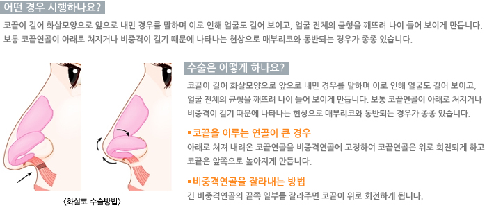 ȭ���ڼ������/� ��� �����ϳ���?/������ ��� �ϳ���?