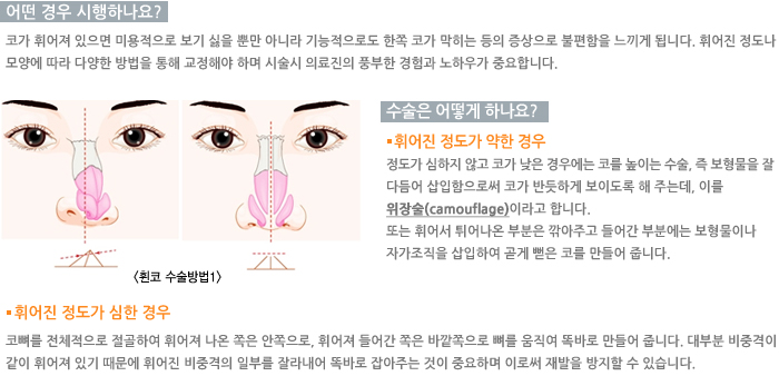 ���ڼ������/� ��� �����ϳ���?/������ ��� �ϳ���?