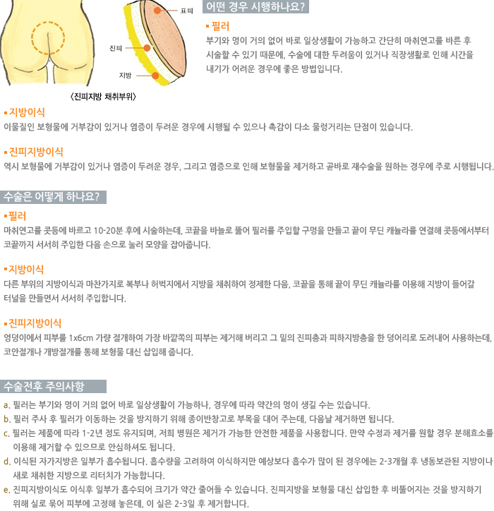 ��������ä�����/� ��� �����ϳ���?/������ ��� �ϳ���?/�����������ǻ���