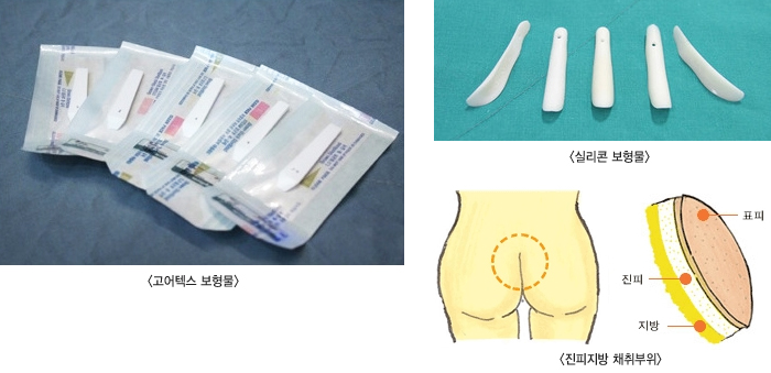 �Ǹ���, �����ؽ�, �Ǹ��ؽ�, �ڰ���������