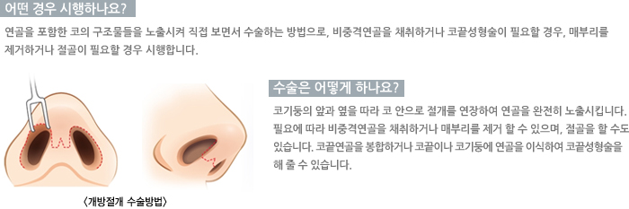 � ��� �����ϳ���?/������ ��� �ϳ���?