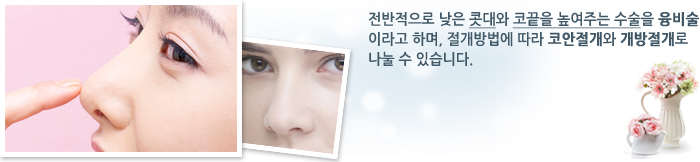 ���������� ���� ���� �ڳ��� �����ִ� ������ ������̶�� �ϸ�, ��������� ���� �ھ������� ���������� ���� �� �ֽ��ϴ�.