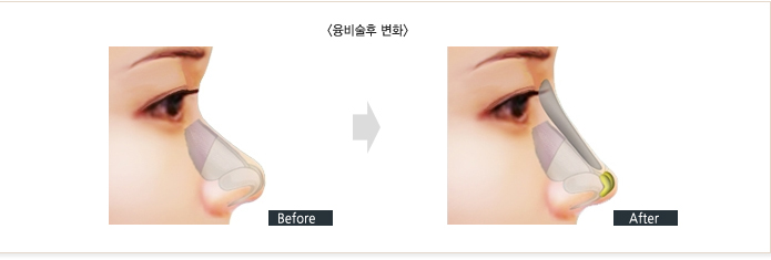 ������Ǻ�ȭ