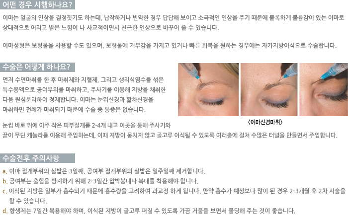 � ��� �����ϳ���?/������ ��� �ϳ���?/�������� ���ǻ���