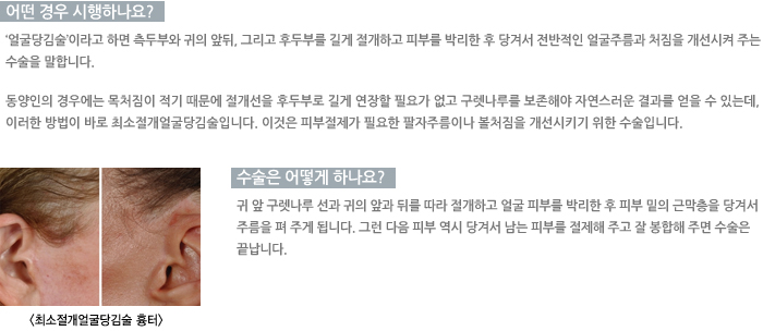 �ּ������󱼴�������/� ��� �����ϳ���?/������ ��� �ϳ���?