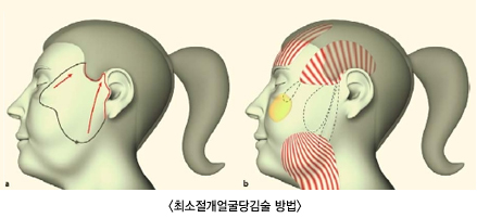 �ּ������󱼴������1/�ּ������󱼴������2