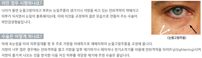 ���������ָ�/� ��� �����ϳ���?/������ ��� �ϳ���?