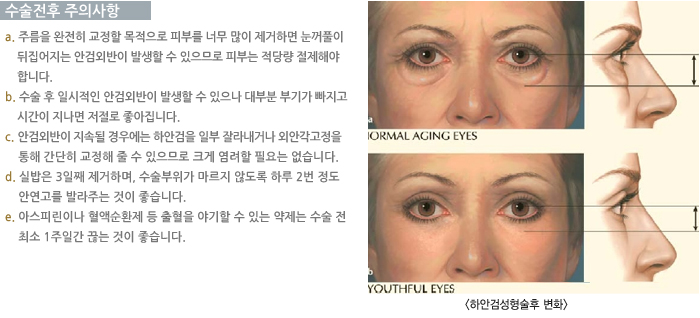 �������� ���ǻ���