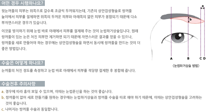 � ��� �����ϳ���?/������ ��� �ϳ���/�������� ���ǻ���