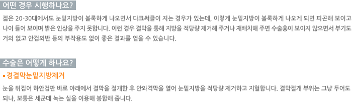 � ��� �����ϳ���?/������ ��� �ϳ���