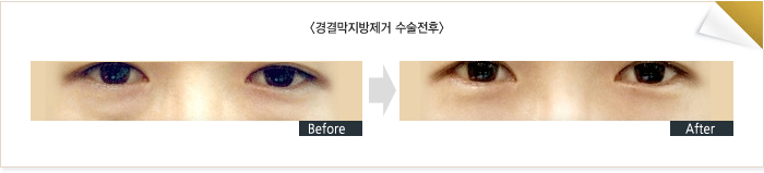 ��ḷ�������ż�������