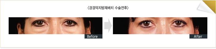 ��ḷ�����������ġ��������