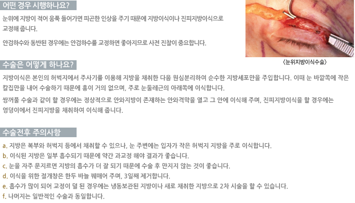 ���������̽ļ���/� ��� �����ϳ���?/������ ��� �ϳ���/�����������ǻ���