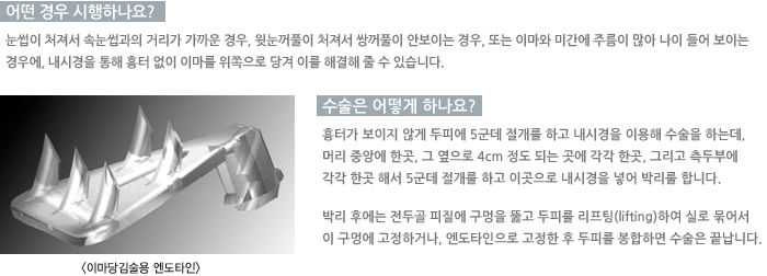 �̸������뿣��Ÿ��/� ��� �����ϳ���?/������ ��� �ϳ���? /�������� ���ǻ���