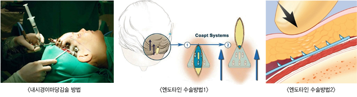 ���ð��̸��������/����Ÿ�μ������1/����Ÿ�μ������2