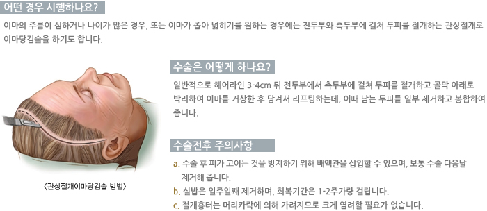 ���������̸��������/� ��� �����ϳ���?/������ ��� �ϳ���? /�������� ���ǻ���