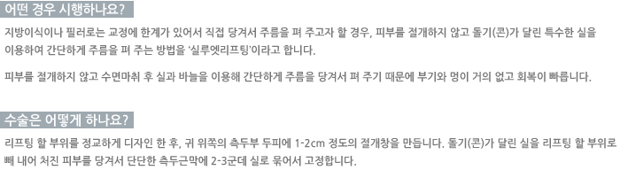 � ��� �����ϳ���?/������ ��� �ϳ���? 