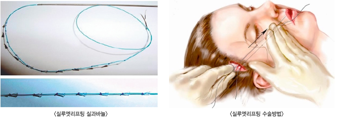 �Ƿ翧������ �ǰ��ٴ�/ �Ƿ翧������ �������