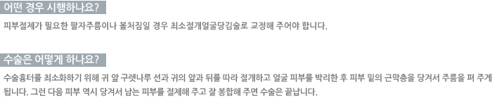 � ��� �����ϳ���?/������ ��� �ϳ���? 