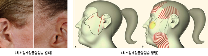 �ּ������󱼴��� ����/ �ּ������󱼴������