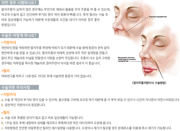 � ��� �����ϳ���?/������ ��� �ϳ���?/�������� ���ǻ��� 