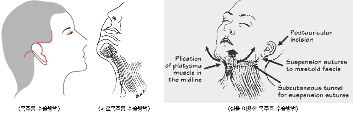 ���ָ��������/���θ��ָ� �������/���� �̿��� ���ָ� �������