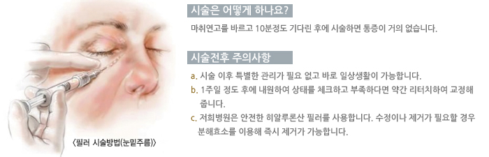 �ʷ��ü����(�����ָ�)/�ü��� ��� �ϳ���?/�ü����� ���ǻ���