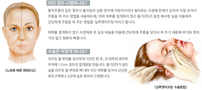 � ��� �����ϳ���?/������ ��� �ϳ���?