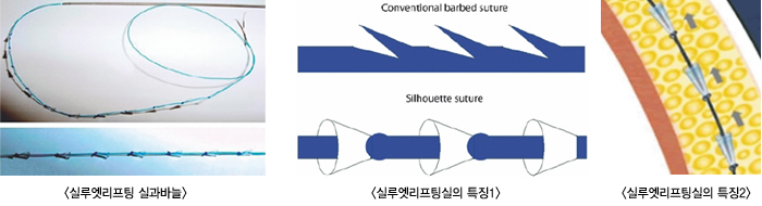 �Ƿ翧������ �ǰ��ٴ�/�Ƿ翧�����ý��� Ư¡1/�Ƿ翧�����ý��� Ư¡2