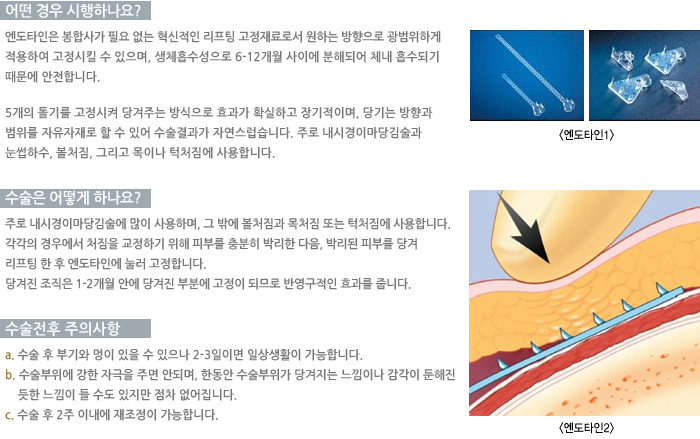 � ��� �����ϳ���?/������ ��� �ϳ���?/�������� ���ǻ���