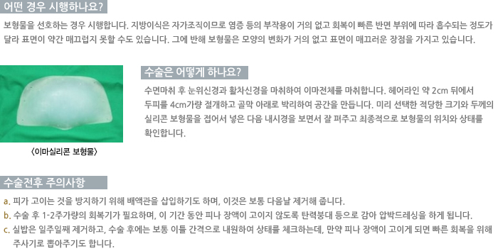 � ��� �����ϳ���?/������ ��� �ϳ���?/�������� ���ǻ��� 