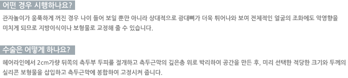 � ��� �����ϳ���?/������ ��� �ϳ���? 