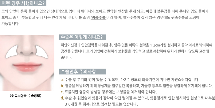 ���������� �������/� ��� �����ϳ���?/������ ��� �ϳ���?/�������� ���ǻ��� 