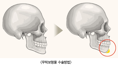 ���κ����� �������