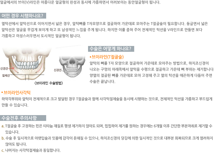 ���̶��ι��/� ��� �����ϳ���?/������ ��� �ϳ���?/�������� ���ǻ��� 