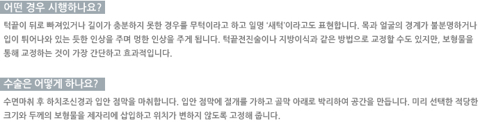 � ��� �����ϳ���?/������ ��� �ϳ���? 