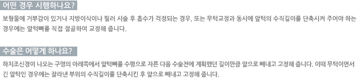 � ��� �����ϳ���?/������ ��� �ϳ���? 